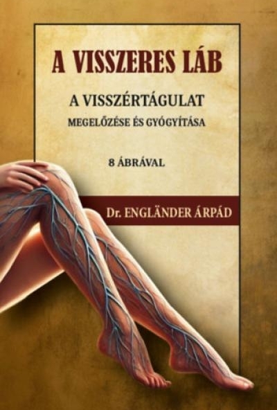 A visszeres láb a visszértágulat megelőzése és gyógyítása